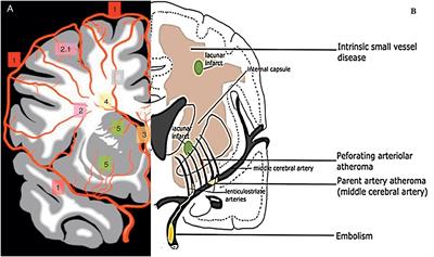 Cerebral Small Vessel Disease (CSVD) – Lessons From the Animal Models